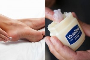 Cách dùng kem dưỡng Vaseline để trị nứt gót chân