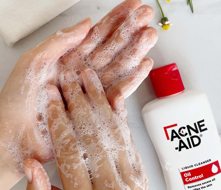 Sữa rửa mặt Acne Aid Không chứa xà phòng và các chất gây kích ứng da 